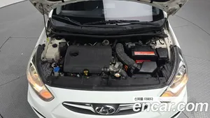 Hyundai Accent, 2014 — миниатюра 6